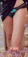 しのぶ